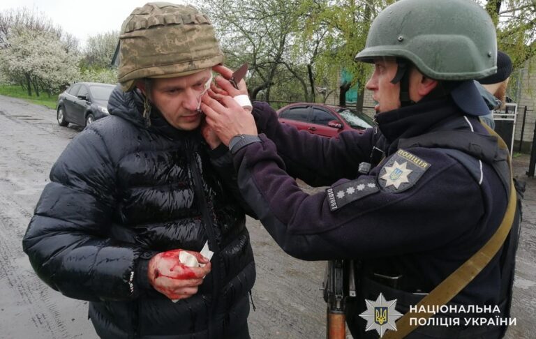 Фото для новини:На Дніпропетровщині чоловіка кинув гранату в п'ятьох поліцейських