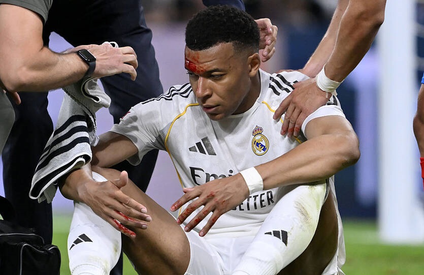 Фото для новини:Розсічення не завада: Мбаппе очікують у матчі Ліги чемпіонів