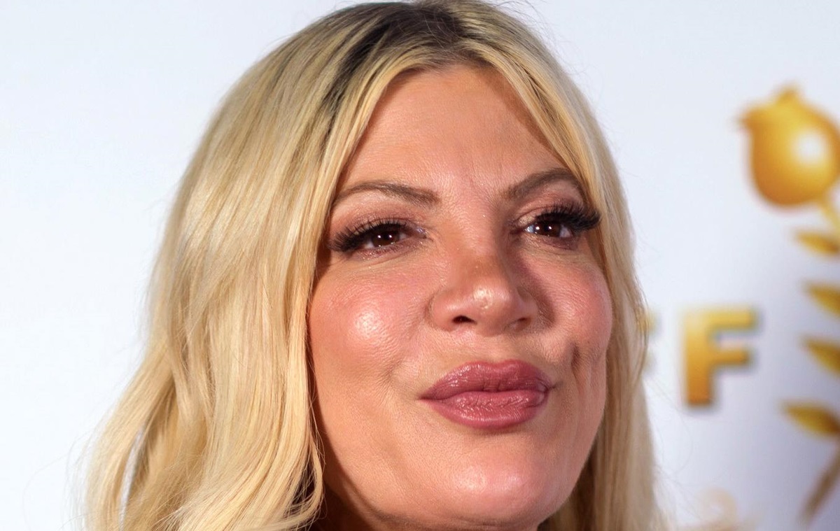 Фото для новини:Зірка Беверлі-Гіллз стала жертвою моторошної ДТП