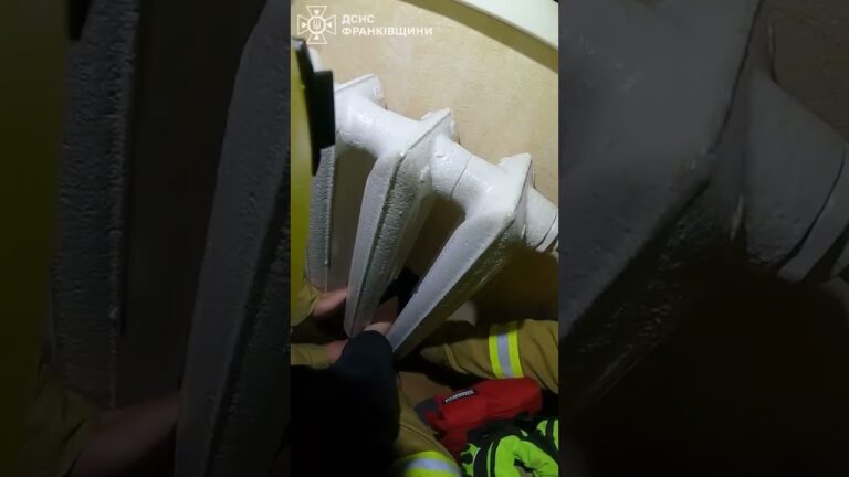 Фото для новини:У Франківську рятувальники вивльнили ногу з батареї 10-річному хлопчику