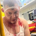 Фото для новини:У Польщі стався черговий напад на українців