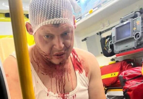 Фото для новини:У Польщі стався черговий напад на українців