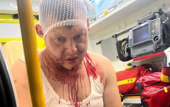 Фото для новини:У Польщі стався черговий напад на українців